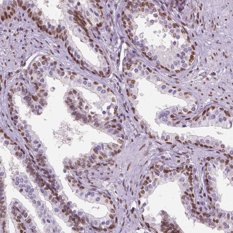 C1orf112 Antibody - BSA Free Immunohistochemistry-Paraffin: C1orf112 Antibody - BSA Free [NBP1-83836]