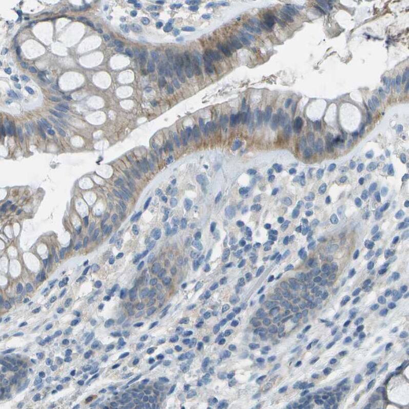 LGI2 Antibody - BSA Free Immunohistochemistry-Paraffin: LGI2 Antibody - BSA Free [NBP1-83839]