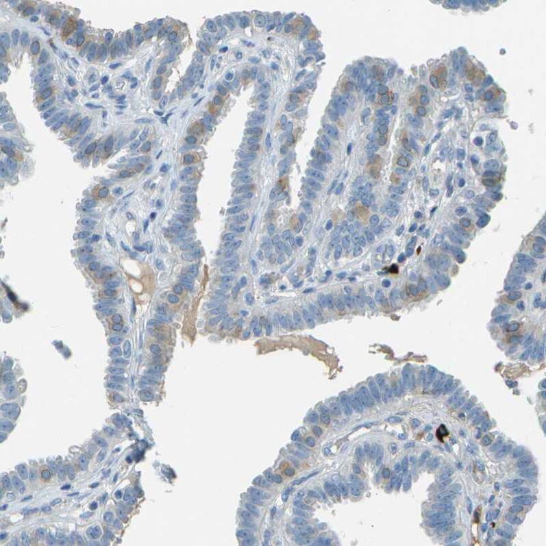 LGI2 Antibody - BSA Free Immunohistochemistry-Paraffin: LGI2 Antibody - BSA Free [NBP1-83839]