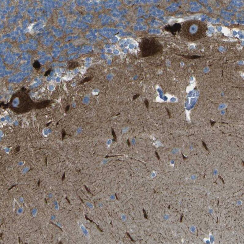 LGI2 Antibody - BSA Free Immunohistochemistry-Paraffin: LGI2 Antibody - BSA Free [NBP1-83839]