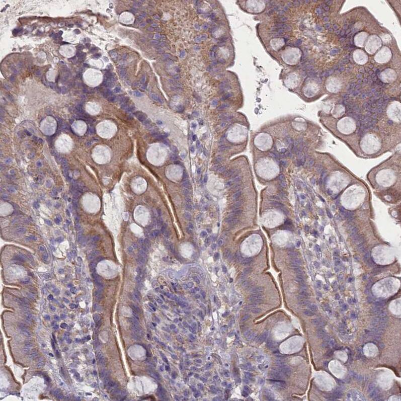 PLEKHG6 Antibody - BSA Free Immunohistochemistry-Paraffin: PLEKHG6 Antibody - BSA Free [NBP1-83840]