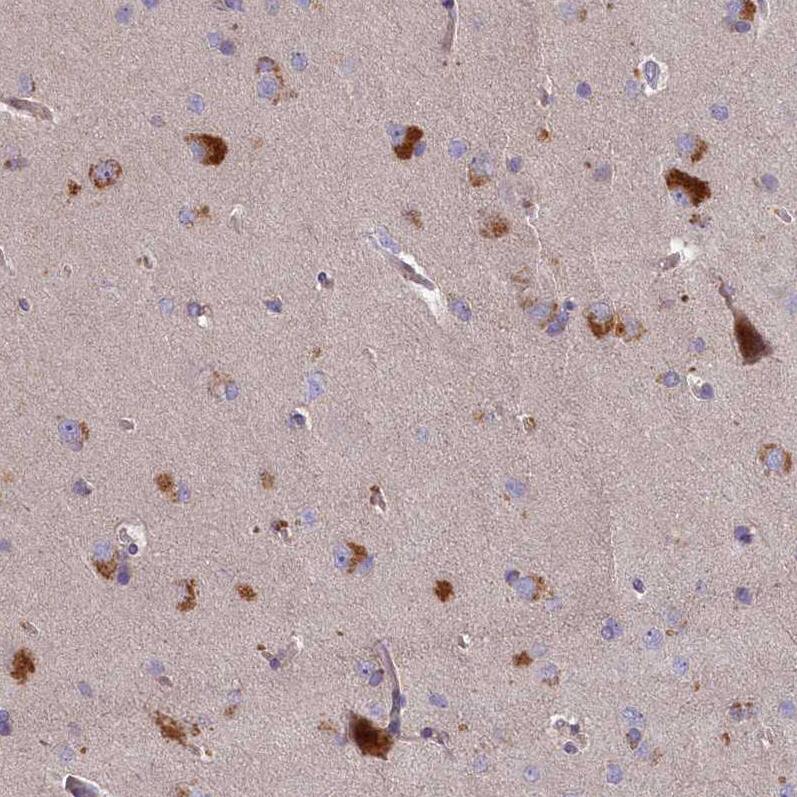 PLEKHG6 Antibody - BSA Free Immunohistochemistry-Paraffin: PLEKHG6 Antibody - BSA Free [NBP1-83840]