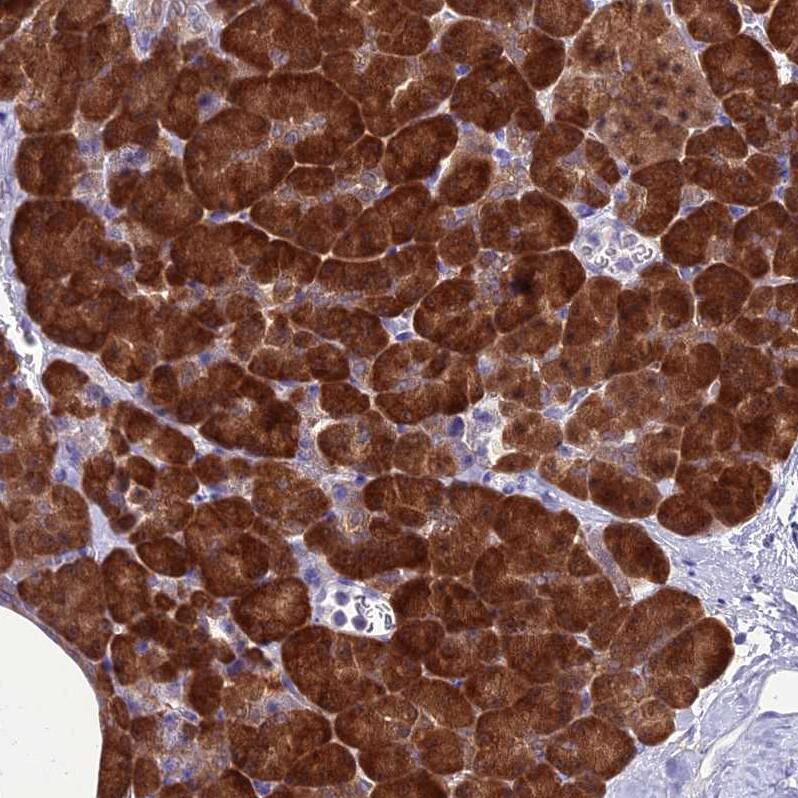 GNPNAT1 Antibody - BSA Free Immunohistochemistry-Paraffin: GNPNAT1 Antibody - BSA Free [NBP1-83842]
