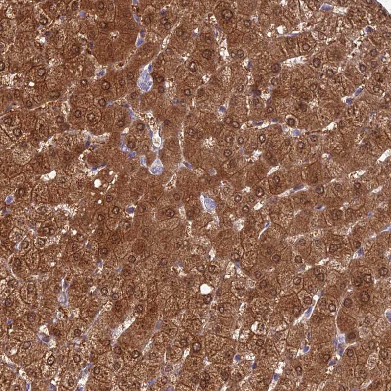 GNPNAT1 Antibody - BSA Free Immunohistochemistry-Paraffin: GNPNAT1 Antibody - BSA Free [NBP1-83842]