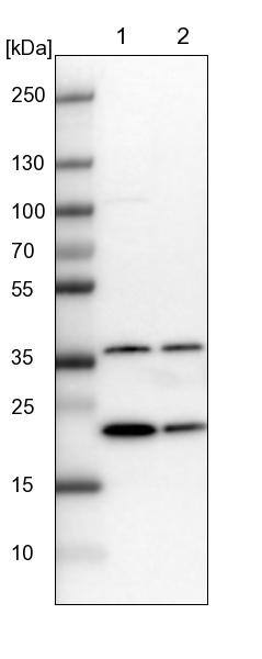 GNPNAT1 Antibody - BSA Free Western Blot: GNPNAT1 Antibody - BSA Free [NBP1-83842]