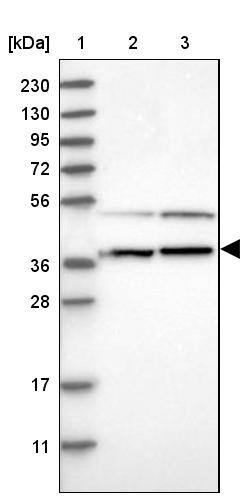 RNMTL1 Antibody - BSA Free Western Blot: RNMTL1 Antibody - BSA Free [NBP1-83844]