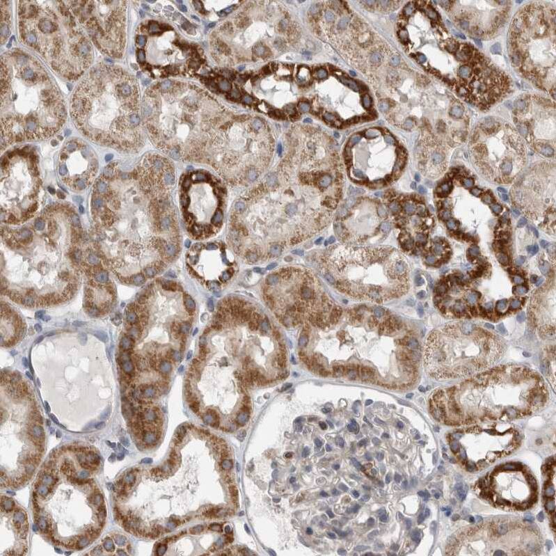 DARS2 Antibody - BSA Free Immunohistochemistry-Paraffin: DARS2 Antibody - BSA Free [NBP1-83854]
