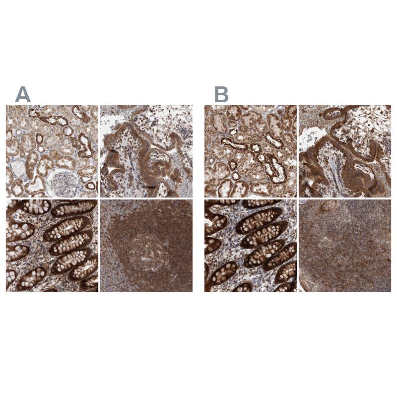 DARS2 Antibody - BSA Free Immunohistochemistry-Paraffin: DARS2 Antibody - BSA Free [NBP1-83854]