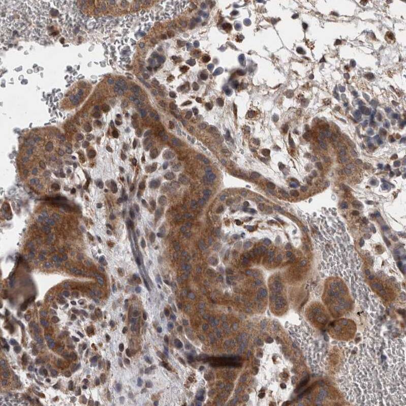 DARS2 Antibody - BSA Free Immunohistochemistry-Paraffin: DARS2 Antibody - BSA Free [NBP1-83854]