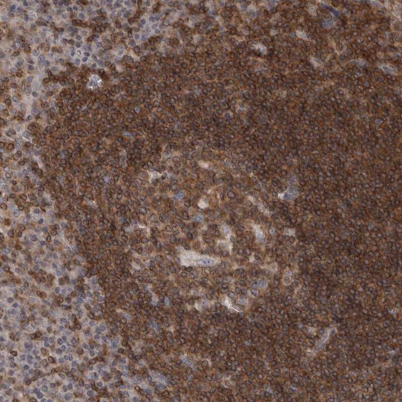 DARS2 Antibody - BSA Free Immunohistochemistry-Paraffin: DARS2 Antibody - BSA Free [NBP1-83854]