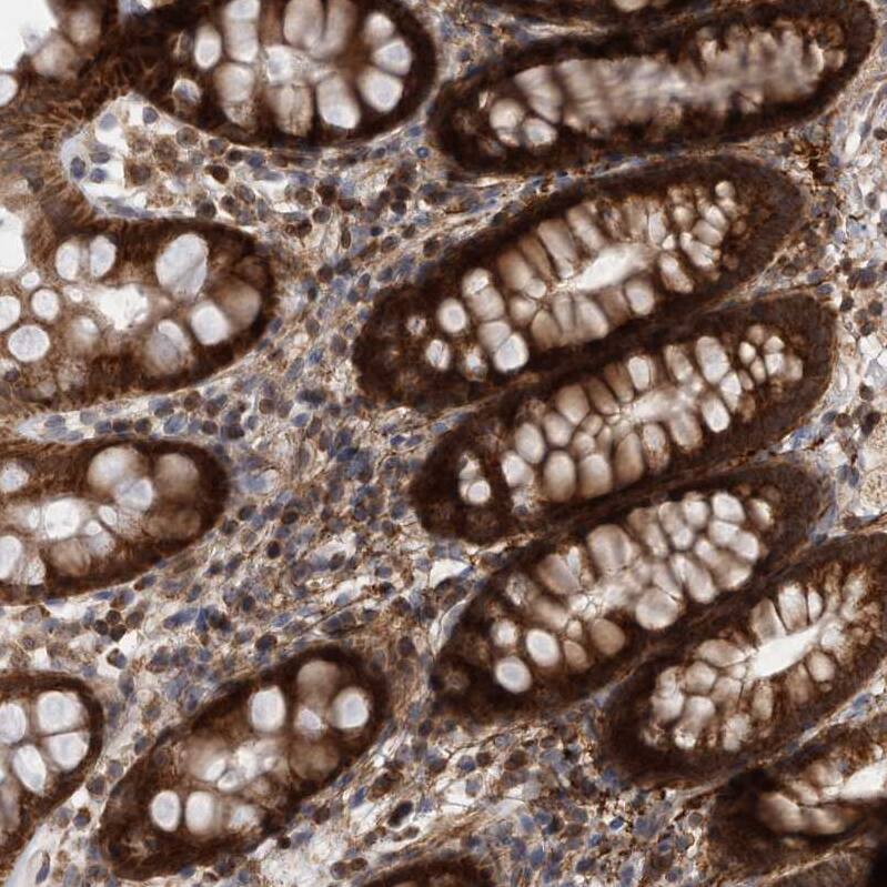 DARS2 Antibody - BSA Free Immunohistochemistry-Paraffin: DARS2 Antibody - BSA Free [NBP1-83854]