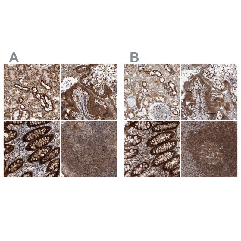 DARS2 Antibody - BSA Free Immunohistochemistry-Paraffin: DARS2 Antibody - BSA Free [NBP1-83855]