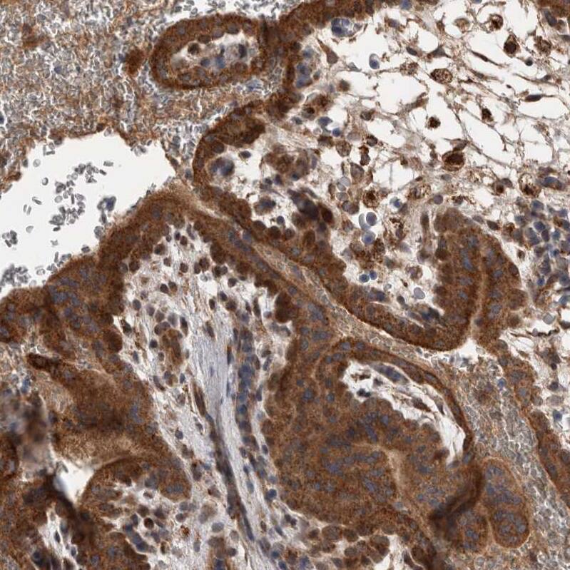 DARS2 Antibody - BSA Free Immunohistochemistry-Paraffin: DARS2 Antibody - BSA Free [NBP1-83855]