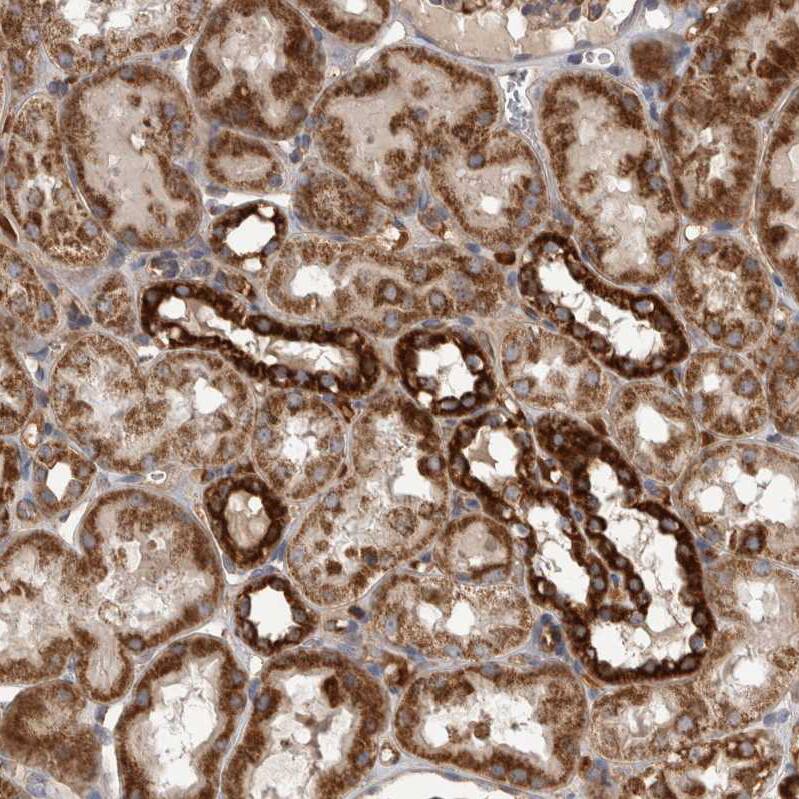DARS2 Antibody - BSA Free Immunohistochemistry-Paraffin: DARS2 Antibody - BSA Free [NBP1-83855]