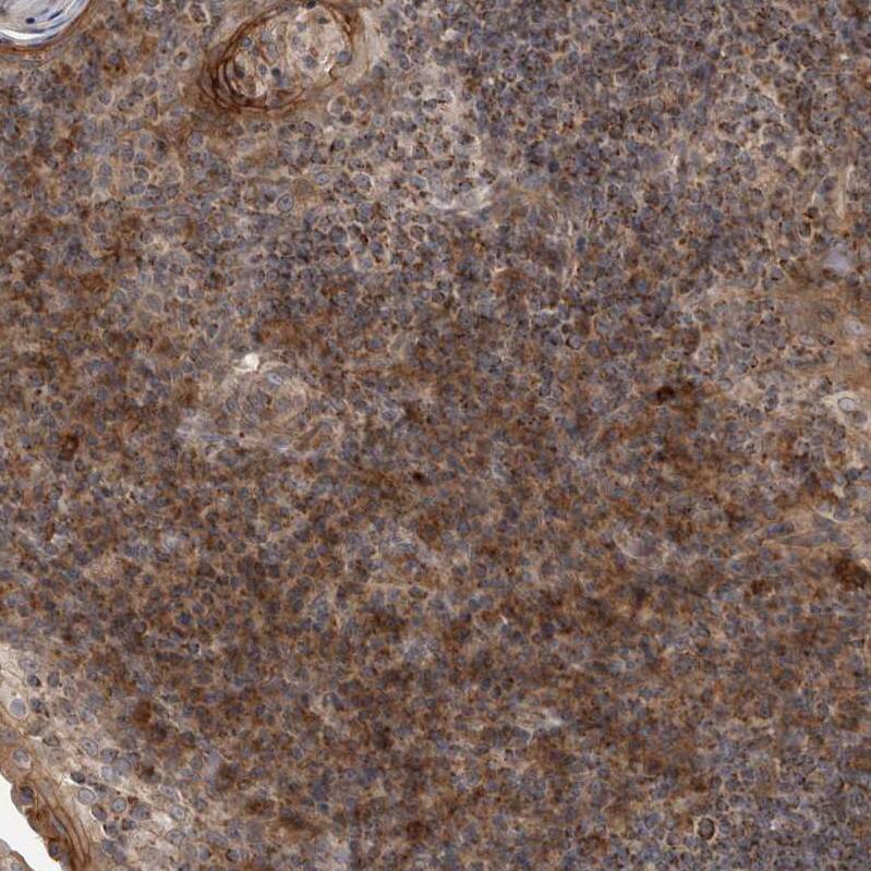 DARS2 Antibody - BSA Free Immunohistochemistry-Paraffin: DARS2 Antibody - BSA Free [NBP1-83855]