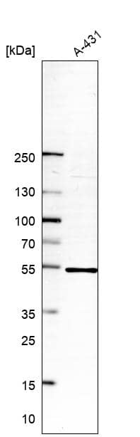 NLE1 Antibody - BSA Free Western Blot: NLE1 Antibody - BSA Free [NBP1-83860]