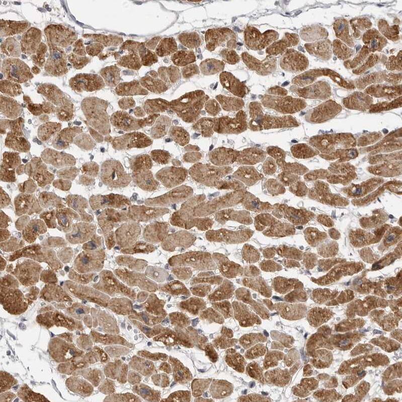MAP7D1 Antibody - BSA Free Immunohistochemistry-Paraffin: MAP7D1 Antibody - BSA Free [NBP1-83866]