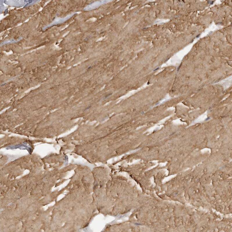 MAP7D1 Antibody - BSA Free Immunohistochemistry-Paraffin: MAP7D1 Antibody - BSA Free [NBP1-83866]