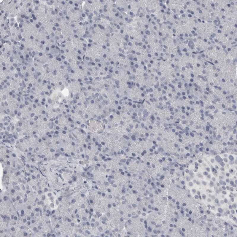 MAP7D1 Antibody - BSA Free Immunohistochemistry-Paraffin: MAP7D1 Antibody - BSA Free [NBP1-83866]