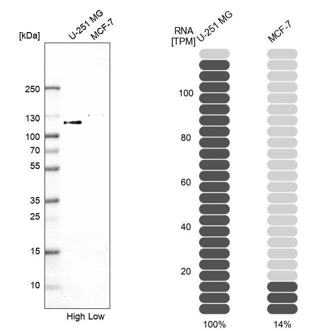 MAP7D1 Antibody - BSA Free Western Blot: MAP7D1 Antibody - BSA Free [NBP1-83866]