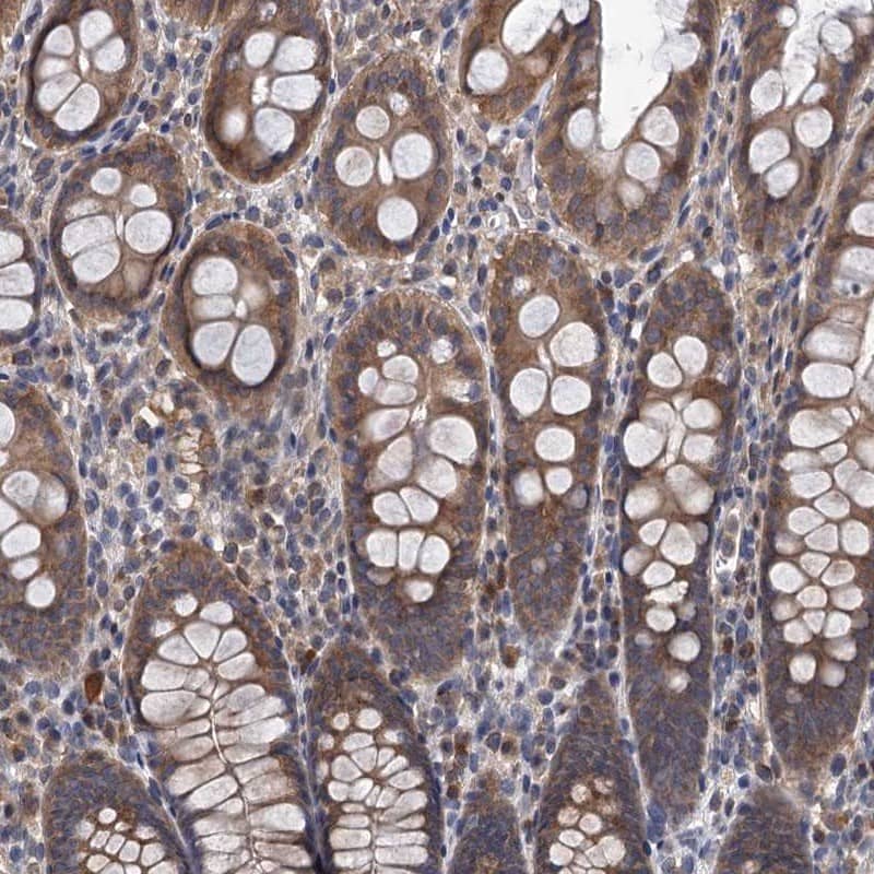 TMEM39B Antibody - BSA Free Immunohistochemistry-Paraffin: TMEM39B Antibody [NBP1-83868]