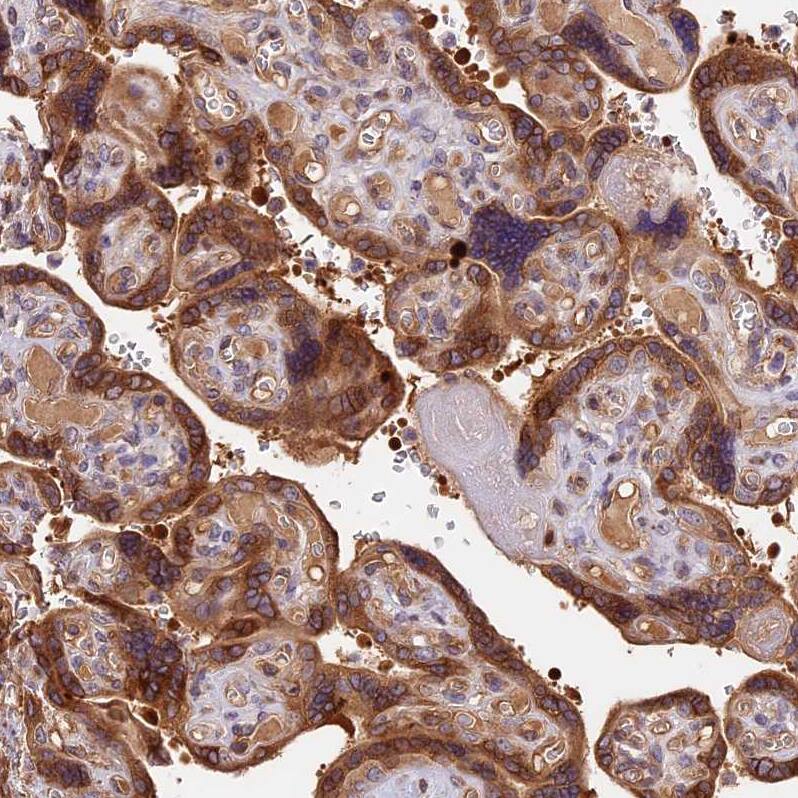 ARHGAP17 Antibody - BSA Free Immunohistochemistry-Paraffin: ARHGAP17 Antibody - BSA Free [NBP1-83870]