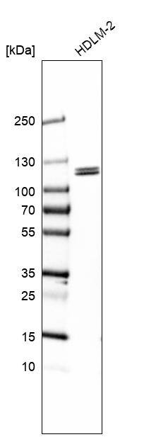 SMEK2 Antibody - BSA Free Western Blot: SMEK2 Antibody - BSA Free [NBP1-83882]
