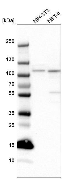 SMEK2 Antibody - BSA Free Western Blot: SMEK2 Antibody - BSA Free [NBP1-83882]