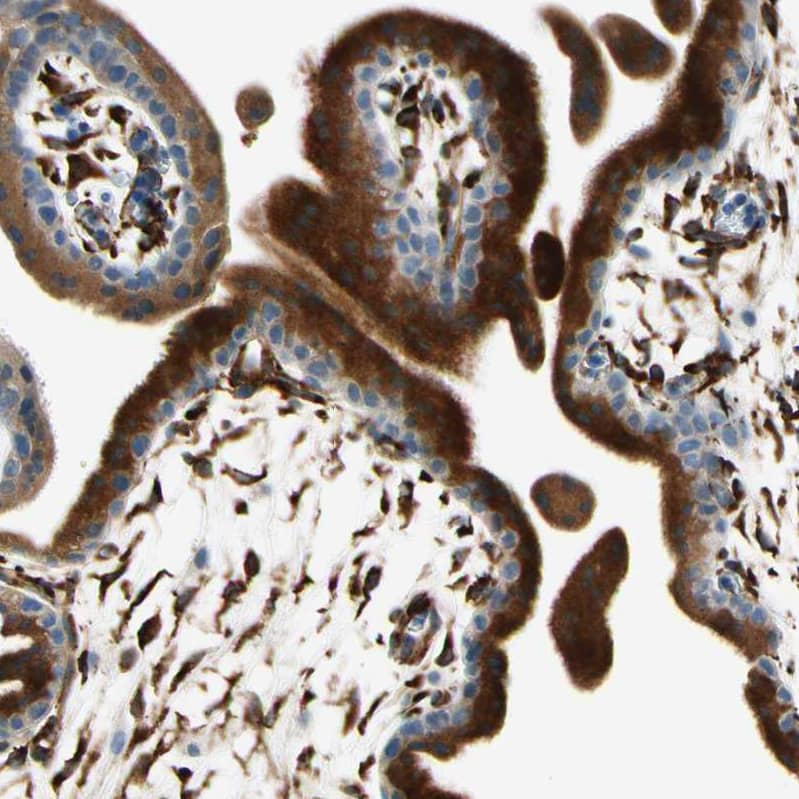 FKBP7 Antibody - BSA Free Immunohistochemistry-Paraffin: FKBP7 Antibody - BSA Free [NBP1-83889]