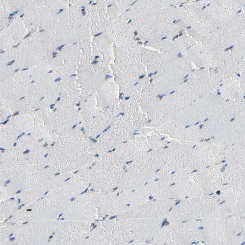 FKBP7 Antibody - BSA Free Immunohistochemistry-Paraffin: FKBP7 Antibody - BSA Free [NBP1-83889]