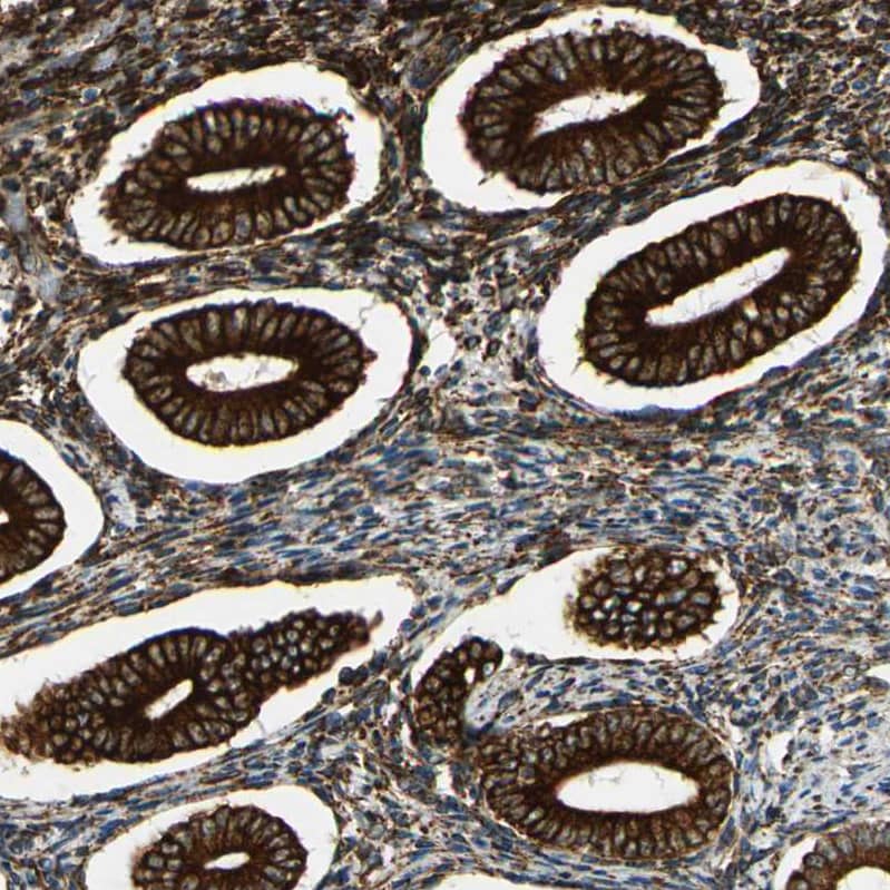 FKBP7 Antibody - BSA Free Immunohistochemistry-Paraffin: FKBP7 Antibody - BSA Free [NBP1-83889]