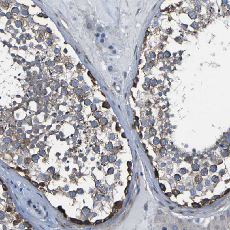 LRRN1/NLRR-1 Antibody - BSA Free Immunohistochemistry-Paraffin: LRRN1/NLRR-1 Antibody - BSA Free [NBP1-83896]