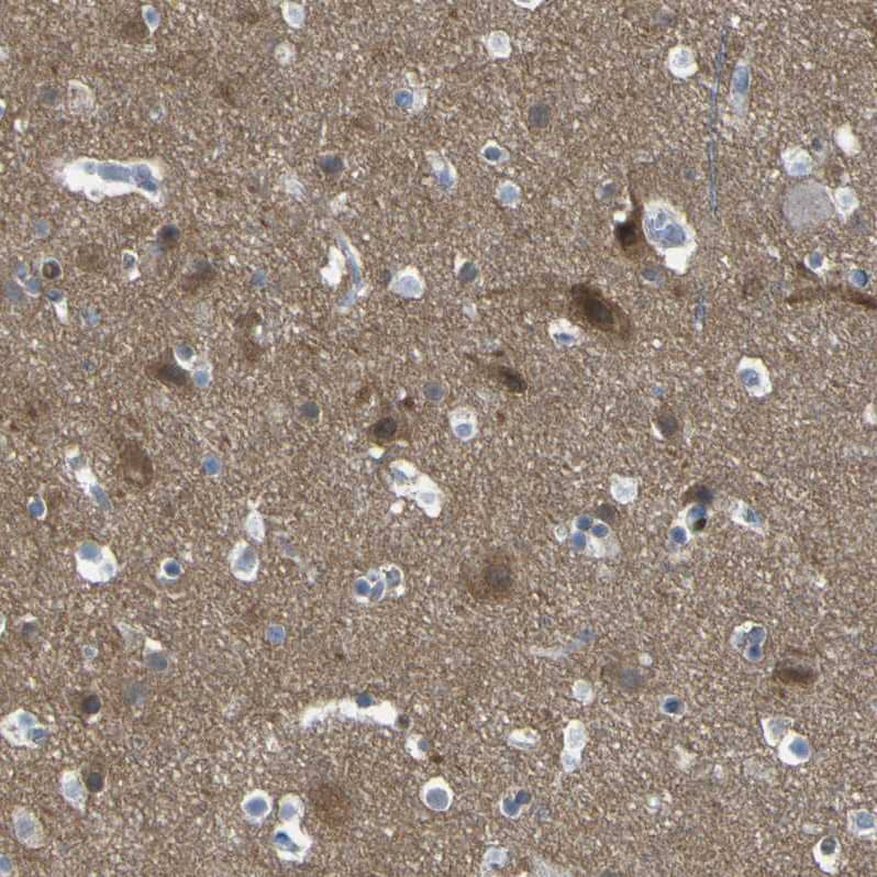 LRRN1/NLRR-1 Antibody - BSA Free Immunohistochemistry-Paraffin: LRRN1/NLRR-1 Antibody - BSA Free [NBP1-83896]