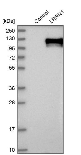 LRRN1/NLRR-1 Antibody - BSA Free Western Blot: LRRN1/NLRR-1 Antibody - BSA Free [NBP1-83896]