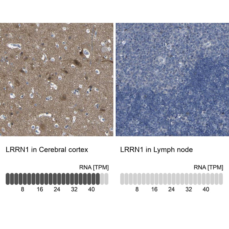 LRRN1/NLRR-1 Antibody - BSA Free Immunohistochemistry-Paraffin: LRRN1/NLRR-1 Antibody - BSA Free [NBP1-83896]
