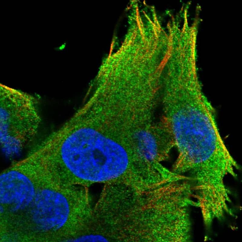 LZTS1 Antibody - BSA Free Immunocytochemistry/ Immunofluorescence: LZTS1 Antibody [NBP1-83908]