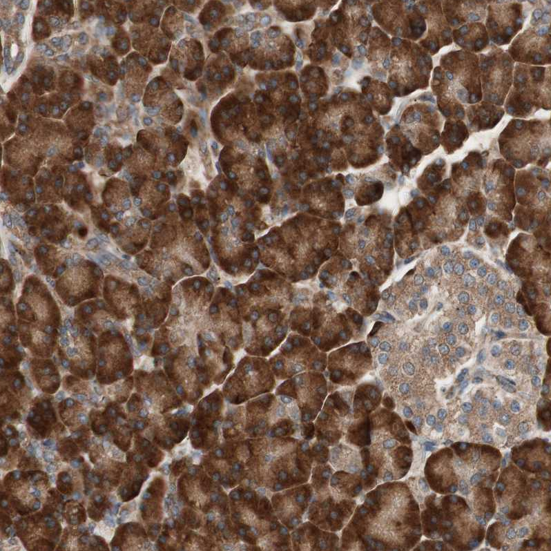LZTS1 Antibody - BSA Free Immunohistochemistry-Paraffin: LZTS1 Antibody - BSA Free [NBP1-83908]