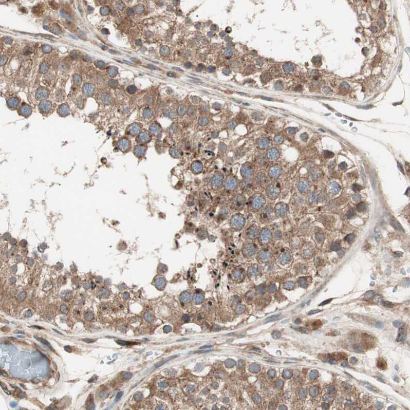 LZTS1 Antibody - BSA Free Immunohistochemistry-Paraffin: LZTS1 Antibody - BSA Free [NBP1-83908]