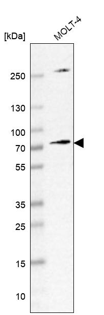 LZTS1 Antibody - BSA Free Western Blot: LZTS1 Antibody - BSA Free [NBP1-83908]