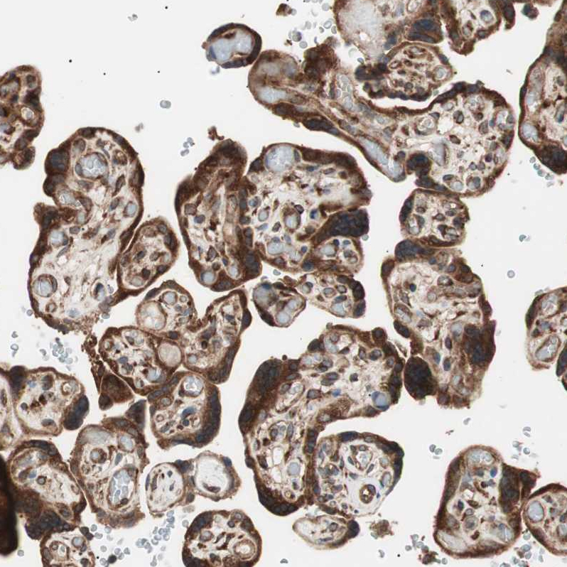 LZTS1 Antibody - BSA Free Immunohistochemistry-Paraffin: LZTS1 Antibody - BSA Free [NBP1-83908]