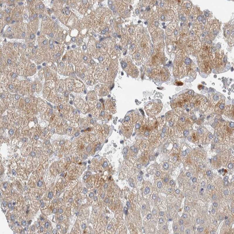 TRIM26 Antibody Immunohistochemistry-Paraffin: TRIM26 Antibody [NBP1-83909]