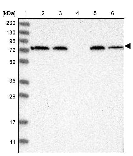 TRIM26 Antibody Western Blot: LYAG/GAA Antibody - BSA Free [NBP1-83909]
