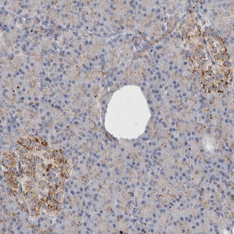 LYAG/GAA Antibody - BSA Free Immunohistochemistry-Paraffin: LYAG/GAA Antibody - BSA Free [NBP2-48576]