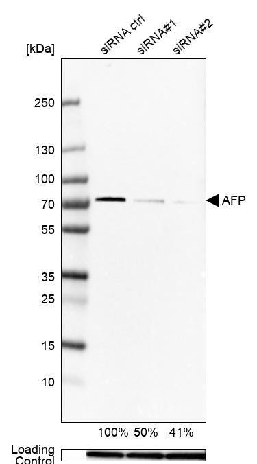 TRIM26 Antibody Western Blot: BTN1A1/Butyrophilin Antibody [NBP1-83910]