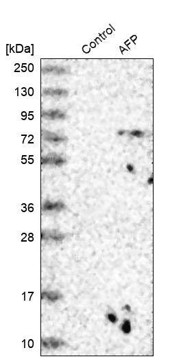 TRIM26 Antibody Western Blot: TRIM26 Antibody [NBP1-83910]