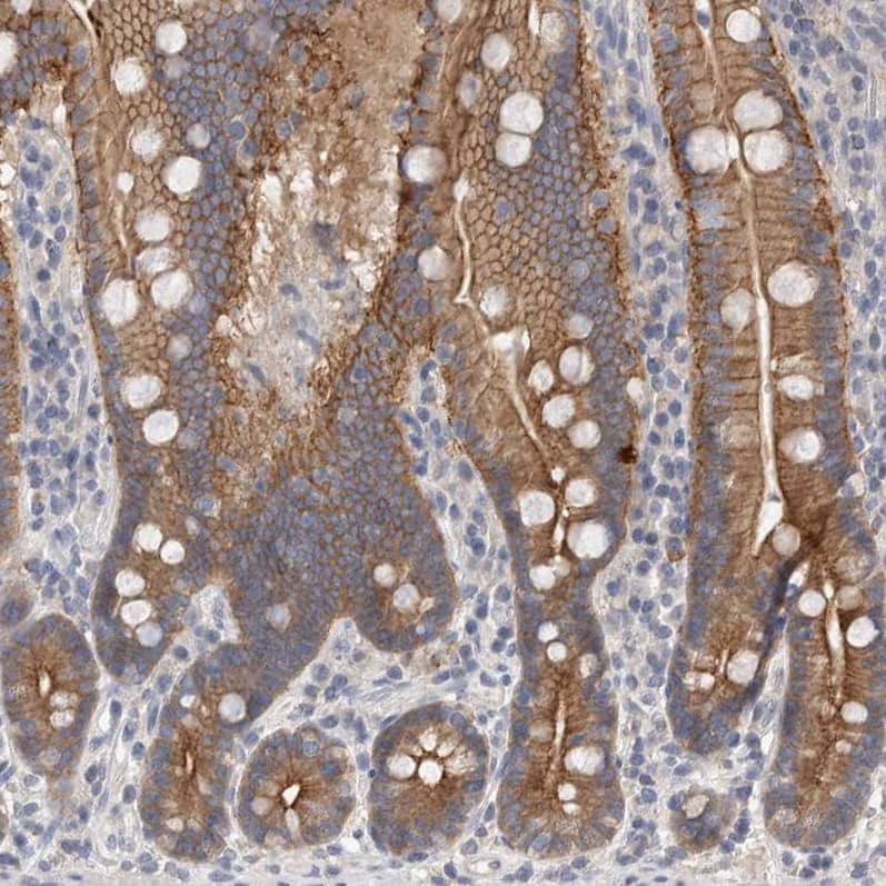 Otoraplin/OTOR Antibody - BSA Free Immunohistochemistry-Paraffin: Otoraplin/OTOR Antibody - BSA Free [NBP1-83912]