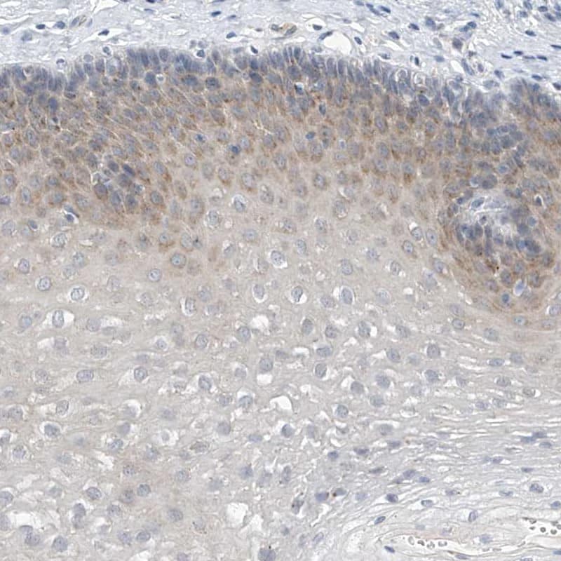 LRRC29 Antibody - BSA Free Immunohistochemistry-Paraffin: LRRC29 Antibody [NBP1-83919]