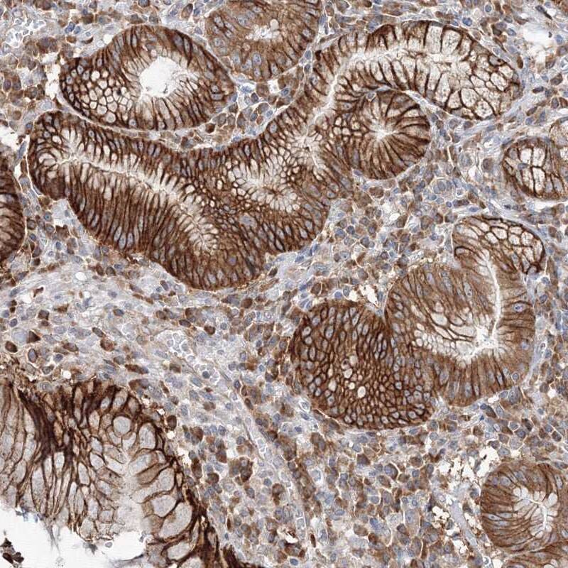Fbxl8 Antibody - BSA Free Immunohistochemistry-Paraffin: Fbxl8 Antibody [NBP1-83920]