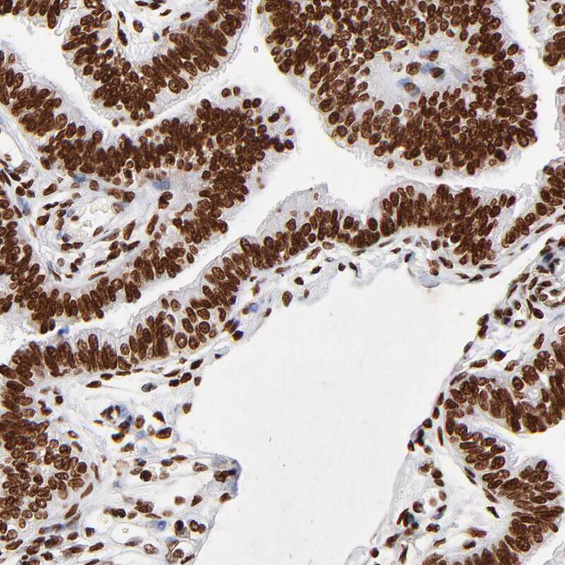 FBXO18 Antibody - BSA Free Immunohistochemistry-Paraffin: FBXO18 Antibody - BSA Free [NBP1-83921]