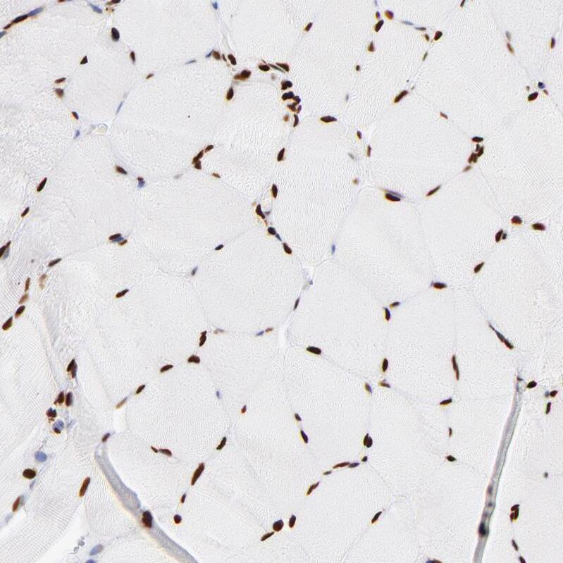 FBXO18 Antibody - BSA Free Immunohistochemistry-Paraffin: FBXO18 Antibody - BSA Free [NBP1-83921]